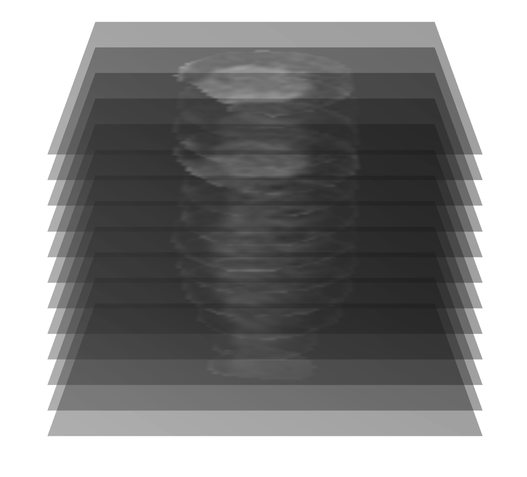 JHU cardiac research: Can AI out diagnose a doctor? episode artwork